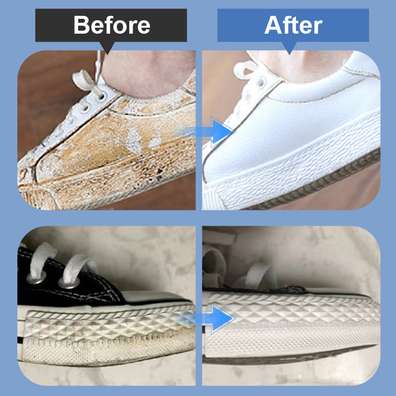 🎁50K+ SOLD! Almost Gone✨Portable Shoe Stain Remover Kit
