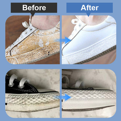 🎁50K+ SOLD! Almost Gone✨Portable Shoe Stain Remover Kit